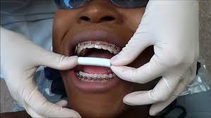 Dental Care